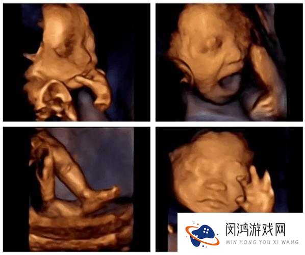 每次做B超医生都会问做四维了吗?了解四维彩超的重要性与必要性