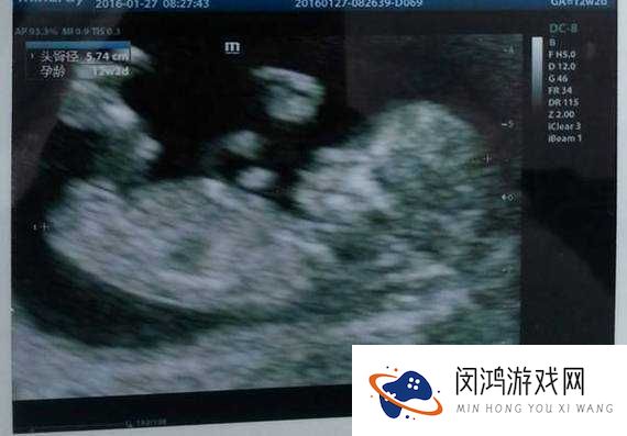 做B超能看出男女吗?揭秘孕期性别鉴定的科学依据与准确性