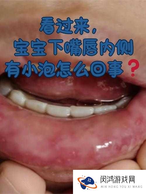 宝宝下面湿透了还嘴硬，这是怎么回事？