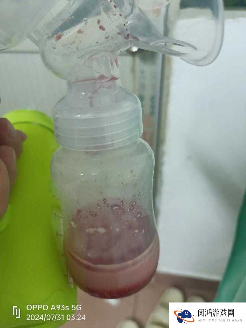 两个男的吃我的乳头怎么办？网友热议解决方法和心理建议全解析